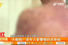老人身上起水泡未重视，没几天蔓延全身又疼又痒，到医院检查吓坏视频封面