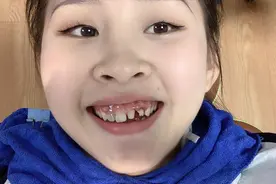 一口28颗牙坏了22颗，补一次要花两万多，再也不敢吃糖了！