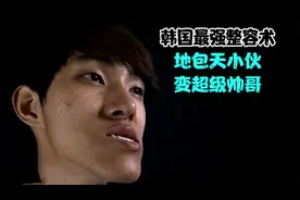 韩国最强整容术，地包天小伙改头换面变超级帅哥视频封面