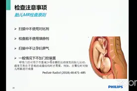 【飞利浦MRI】产前磁共振扫描流程视频封面