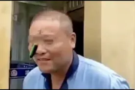 鱼没钓成钓了自己......男子脸挂鱼钩求助消防视频封面