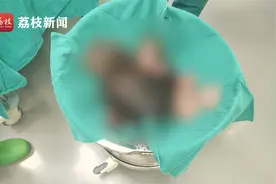 惊悚！女子抱着一袋头皮急救 竟是长发被卷入机器视频封面