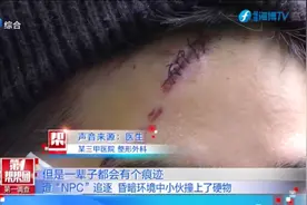 玩“密室逃脱”小伙额头被缝11针，场所隐患引人忧视频封面