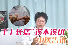 一女子手上黑痣越来越大，担心恶化癌变？听医生说视频封面