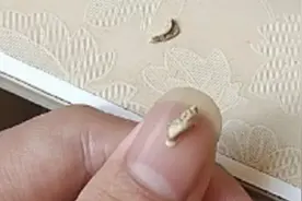 又脏又臭的牙结石一碰就掉？！#超解压视频#强迫症#治愈视频封面