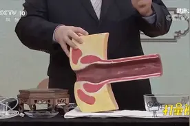 溃疡性结肠炎的灌肠治疗怎么做？专家现场演示，来看看|健康之路