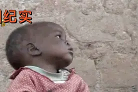 非洲3岁小孩患有艾滋，全身肿胀长满疙瘩，他还能活多久？纪录片视频封面