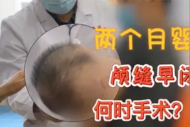 2个月婴儿左右脸不对称，头部偏长并且凹进去了，这是什么原因？视频封面