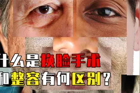 什么是换脸手术？美国男子车祸毁容，如何换手换脸重获新生视频封面