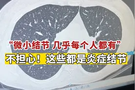 肺内发现多个微小结节？不慌！医生：几乎每个人都有视频封面