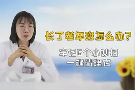 脸上长老年斑怎么办？牢记这6个有效方法，或能帮你“一键清理”