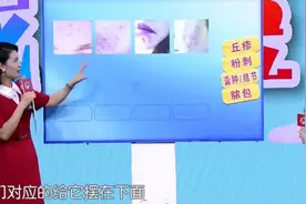 四张图片教你认识不同程度的痤疮，专家告诉你如何区分，涨知识了视频封面