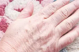 手部粗糙起皮不用愁？一个小方法，皮肤立马光滑细嫩，省钱又省心视频封面