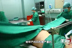 生命缘：三胞胎孕妇33周，羊水突然破裂，分娩过程惊险万分视频封面