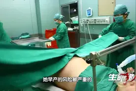 生命缘：三胞胎孕妇33周，羊水突然破裂，分娩过程惊险万分视频封面