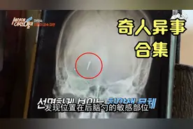 脑袋里长了2厘米金属块，60年无任何不适，金属来源成了不解之谜视频封面