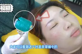💉真人手把手教你微针，微针实操来啦