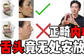 舌位自查指南，你的舌头真的放对了吗？
