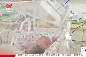 “换脸”男婴手术愈合不佳，二次手术后达到预期，与家人团聚视频封面
