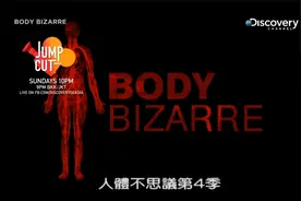 人体不思议印尼孟加拉树人猎奇解压视频罕见病视频封面