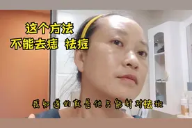 曼生活祛斑第61天，之前满脸是斑，现在被夸皮肤好看！自信满满！