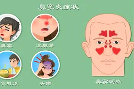 鼻子总堵？爱流鼻涕？中国鼻窦炎患者近2800万？鼻窦炎症状全解析视频封面