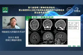 巨大脑瘤能不能手术治疗，有什么风险？神经科学论坛上张永力解答视频封面