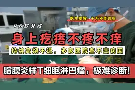身上长的疙瘩不疼不痒，是不是不需要管？医生坦言：千万不能忽视视频封面