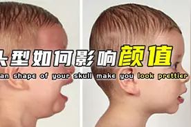 你是圆头还是扁头？颅顶高低真的能决定颜值吗？视频封面