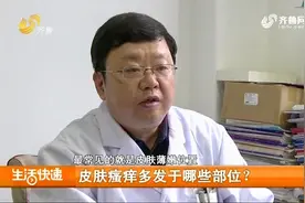 一到冬天皮肤瘙痒咋办？别光挠，专家支招，教你正确治疗皮肤瘙痒视频封面