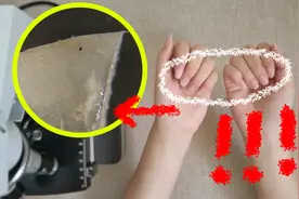 1克指甲盖垢中，有40亿个细菌，来看显微镜下的指甲盖是啥样