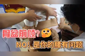 骨盆前倾？ 有可能是你的腰有问题！