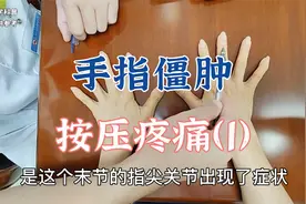 手指关节肿胀僵硬按压疼痛是怎么回事？肖教授查体分析病因（1）视频封面