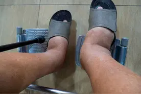 双下肢莫名浮肿，或是这2类病症在“捣鬼”，得及时检查了！视频封面