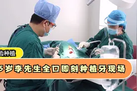 种植牙现场实录：55岁李先生全口即刻种植，用时不到2小时！视频封面