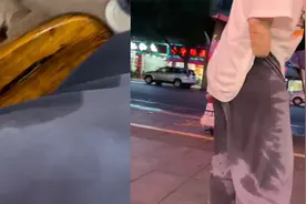 烧伤女生出门太热，整条裤子被汗浸湿尴尬自嘲，网友纷纷送安慰视频封面