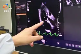 协和医院微创换瓣膜术达国际领先水平视频封面