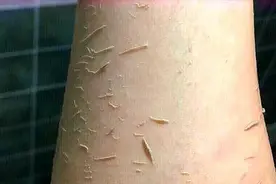 洗澡时搓出的黑泥是什么？显微镜放大200倍，终于看清楚了！视频封面