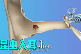 昆虫钻入耳朵怎么办？第一时间采取正确急救措施，真的很重要！视频封面