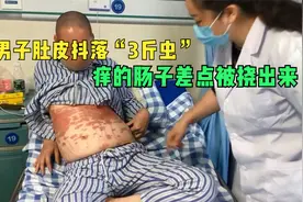 男子肚皮抖落“3斤虫”！牛皮癣痒的掏出肠子！紧急求助刘大夫视频封面