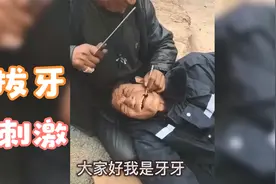 科普拔牙：你会选择怎样的拔牙方法呢？视频封面