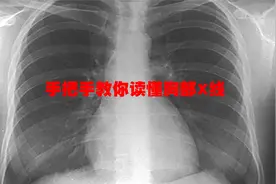 手把手教你读懂胸部X线【转载】视频封面