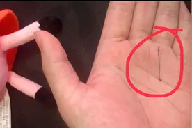 太阳线又称为成功线，有这条线的人都是人生成功的典范