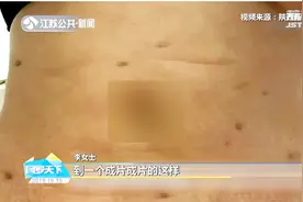 女子身高164体重140斤，花68万抽脂留下50多处疤痕：我快抑郁了视频封面