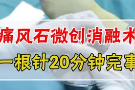 痛风石微创消融术，一根针20分钟完事视频封面