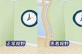 看东西变形，直的变弯?是什么病？视频封面