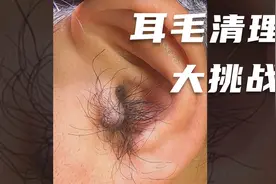 这是吃了啥？耳朵里面长这么多毛？视频封面