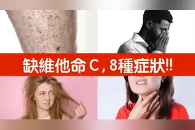 缺維生素C,你不知道的8種症狀!! 柏格醫生 Dr Berg视频封面