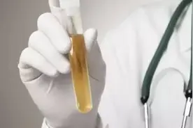 什么是逆行射精，什么原因引起的逆行射精呢视频封面