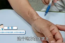 手腕疼痛、使不上力？医生用真实案例告诉您是怎么回事视频封面